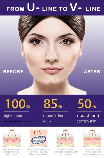 Effective V-Shape Face Slimming Lifting Facial Cream Lift Up V Double Chin Cheek Slimming Firming Anti Wrinkle Beauty Skin Care - AMULET RING STORE