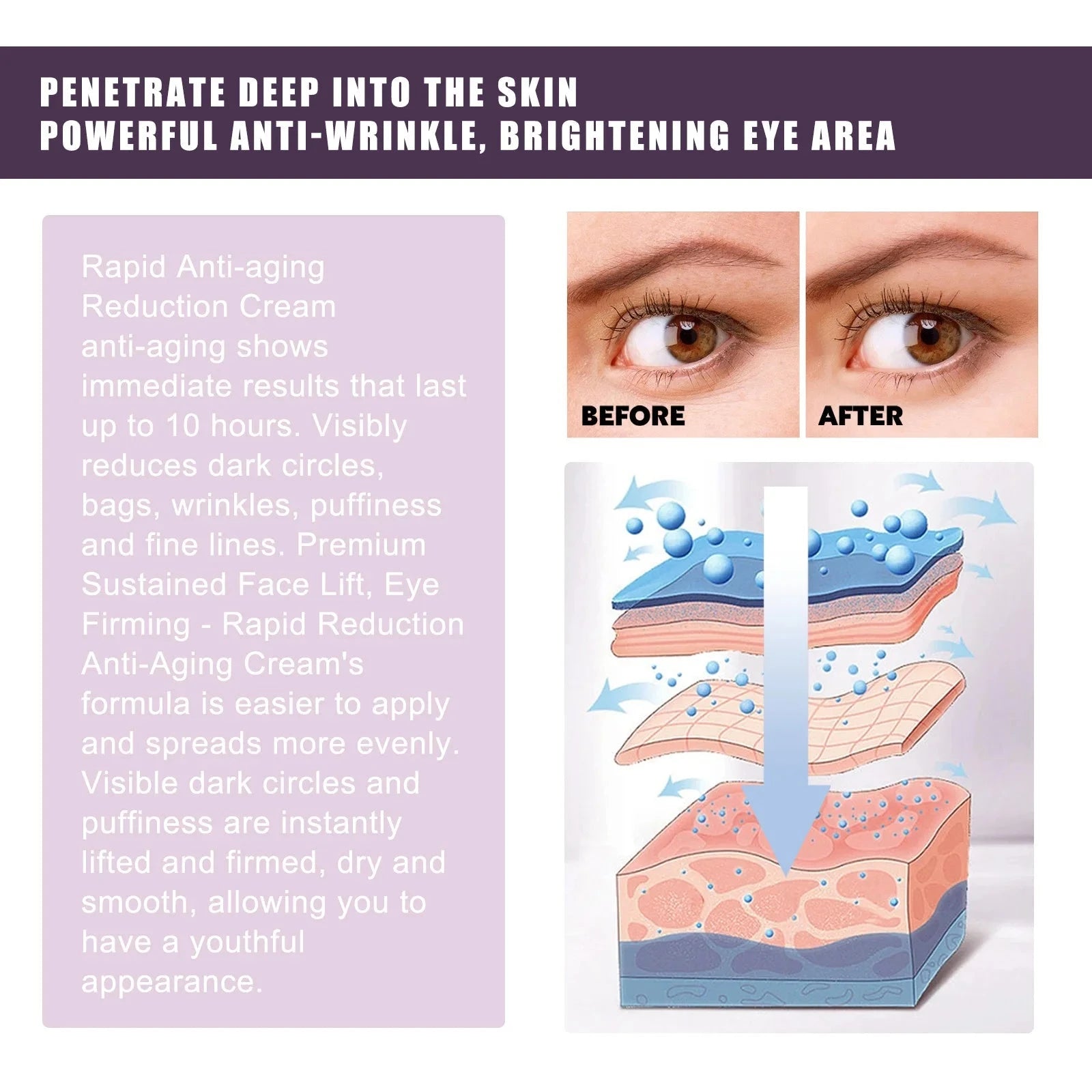 Electric Massage Eye Cream Anti Wrinkle Eye Patches Moisturizing Improve Bags Nourish Area Against Puffiness Bags Hydrate - AMULET RING STORE