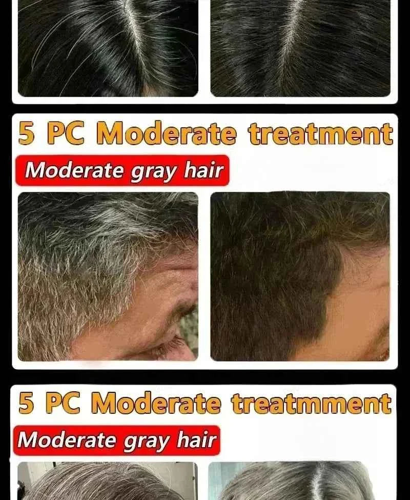 White hair killer, remove gray hair and restore natural hair color in 7 days 2025