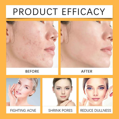 EELHOE Turmeric Essence Oil 30ml Shrink Pores Deep Moisturizing Hydration Repair Damaged Skin Facial Body Massage Oil Skin Care