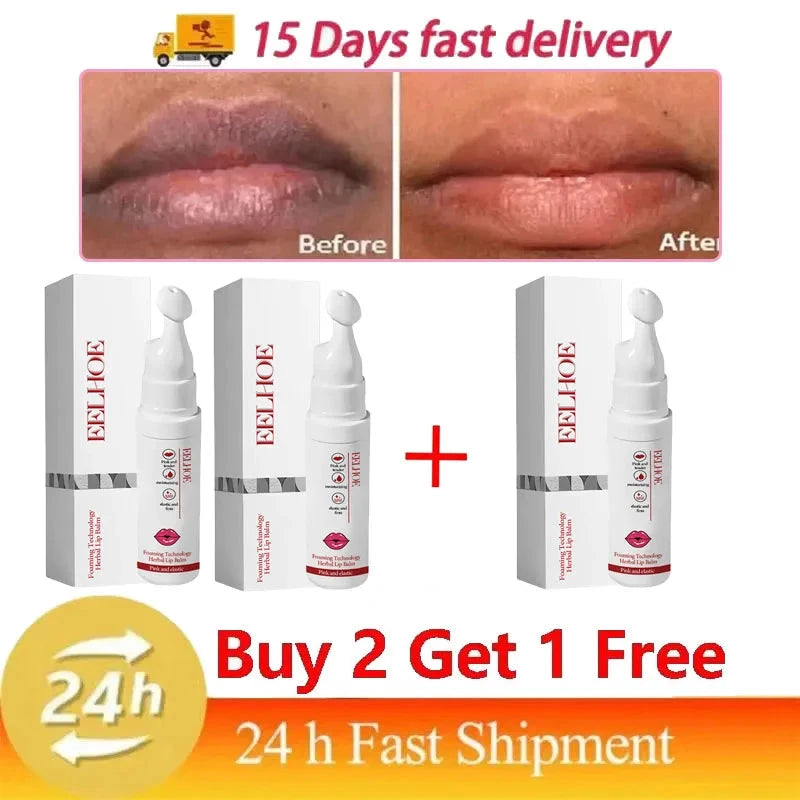 Remove Dark Lip Balm Bubble Lightening Pink Lip Exfoliating Fade Lip Line Dead Skin Moisturizer Beauty Health Lip Care Products - AMULET RING STORE