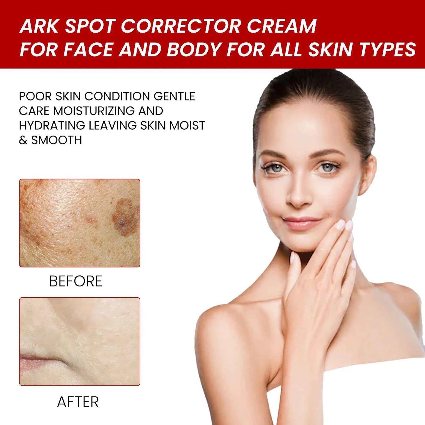 Ouhoe 20g Niacinamide Dark Spots Remover Cream Lighten Melanin Improve Dullness Brighten Skin Tone Smooth Face Repairing Cream