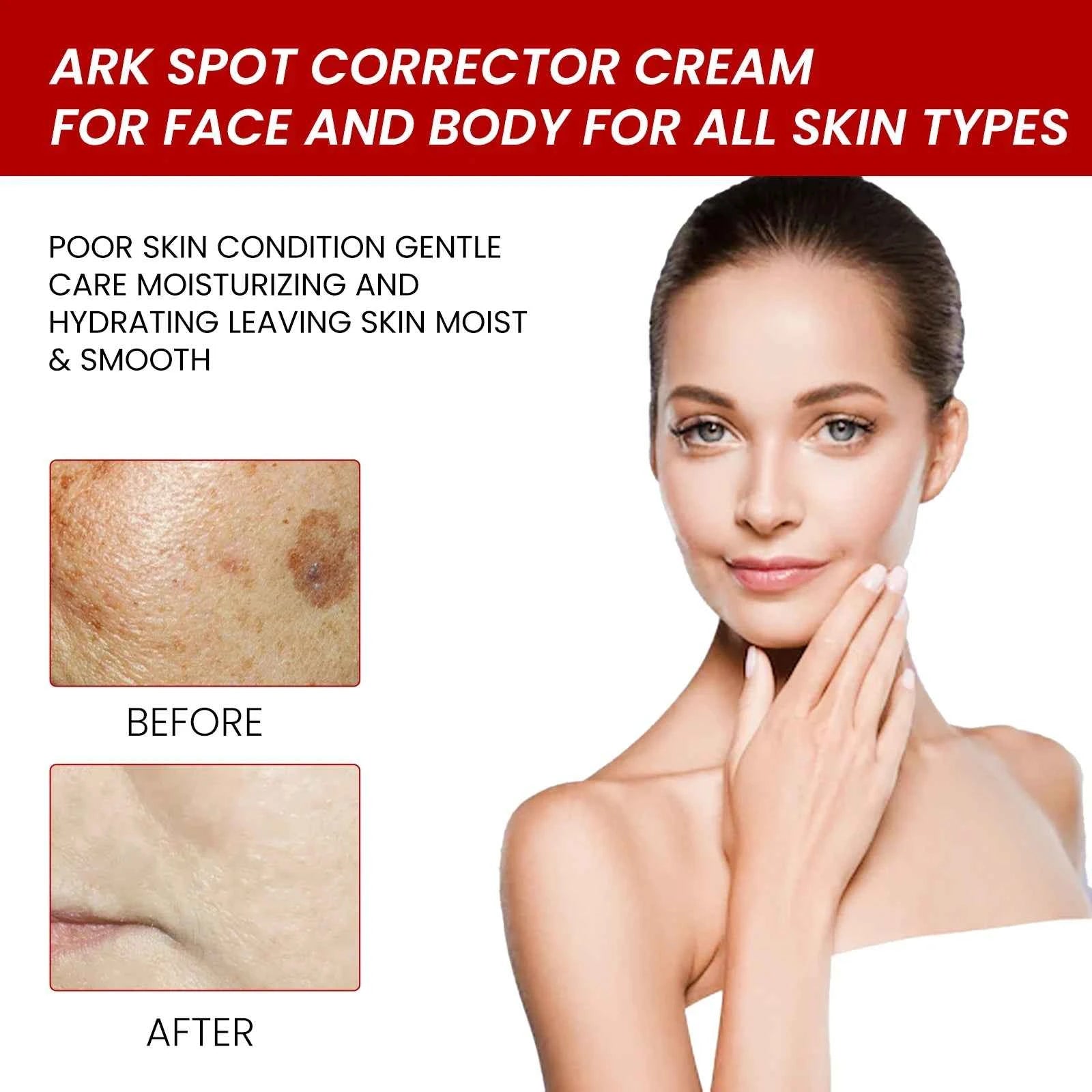 Ouhoe 20g Niacinamide Dark Spots Remover Cream Lighten Melanin Improve Dullness Brighten Skin Tone Smooth Face Repairing Cream