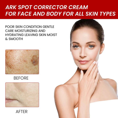 Ouhoe 20g Niacinamide Dark Spots Remover Cream Lighten Melanin Improve Dullness Brighten Skin Tone Smooth Face Repairing Cream