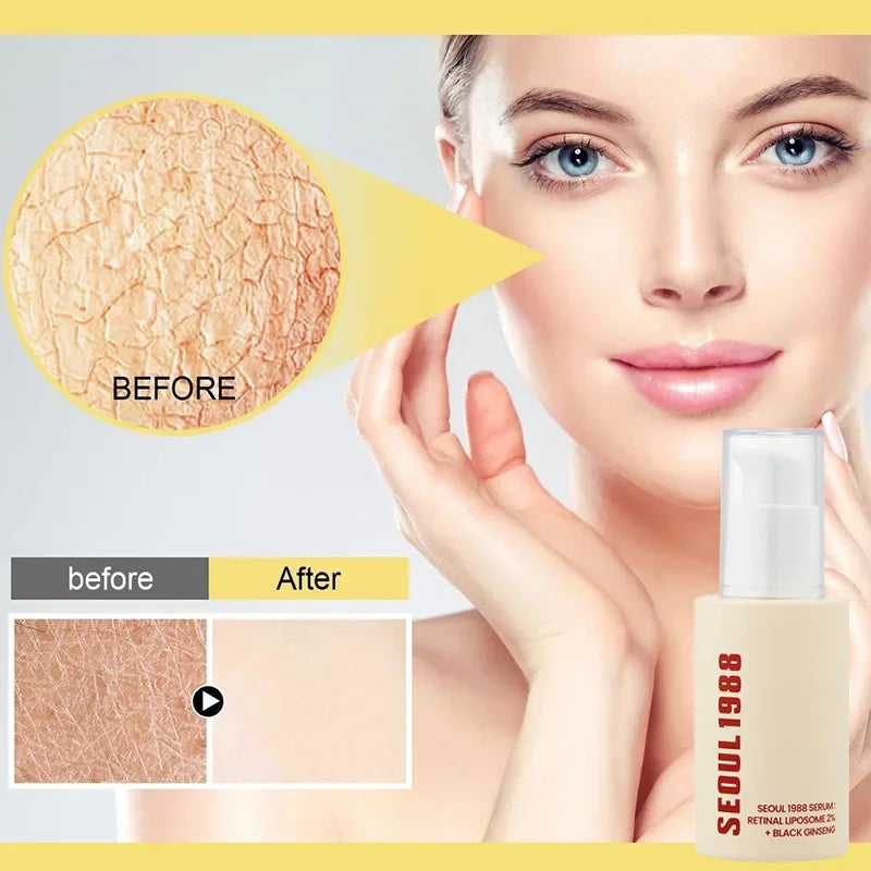 SEOUL 1988 Eye Cream Niacinamide 2% Retinal Acid Ginseng Serum Lighten Fine Lines Firming Pores Brightening Face Korean Skincare - AMULET RING STORE