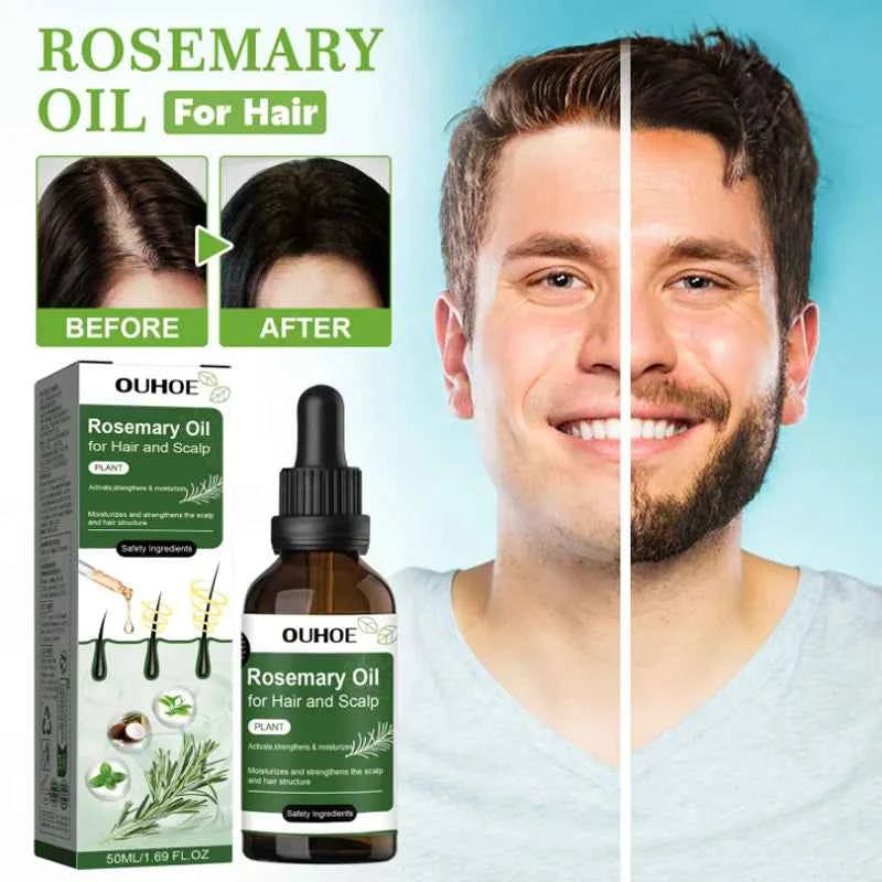 Rosemary Hair Growth Oil Anti Hairs Loss Treatment Mint Hair Strengthening Oil Nourishing Roots Regrowth Hair For Men Women 50ml