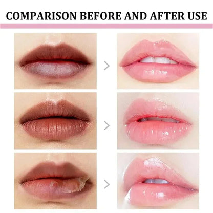 Remove Dark Lip Balm Fast Lightening Pink Lip Exfoliating Fade Lip Line Dead Skin Moisturizer Korean Care Products Beauty Health - AMULET RING STORE