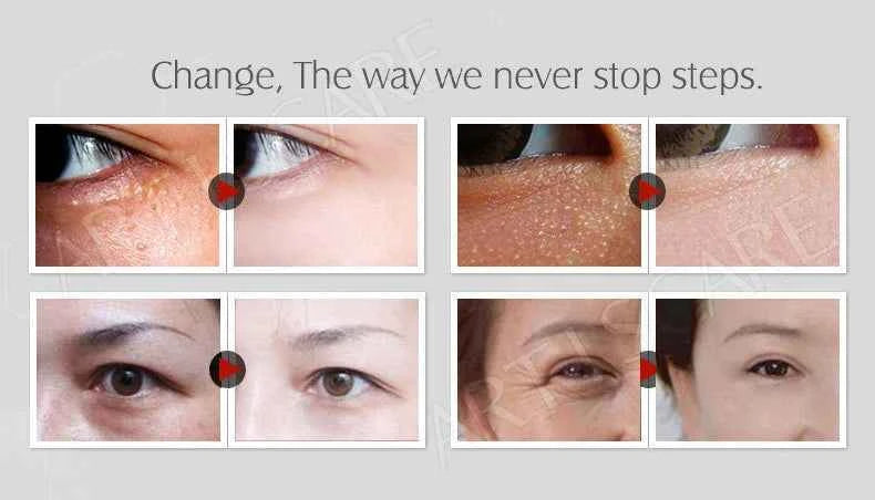 ARTISCARE Aging & Beauty Eyes Serum SET Anti Dark Circles Wrinkles Removal Coenzyme Q10 Six Peptides cream 3Pcs