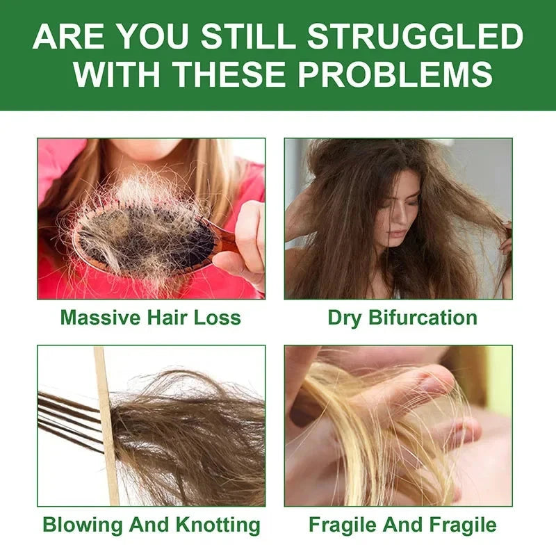 Fast Hair Growth Oil Rosemary Africa Crazy Traction Alopecia Serum Anti Hair Break Thicken Hair Loss Essential Oil For Man Women