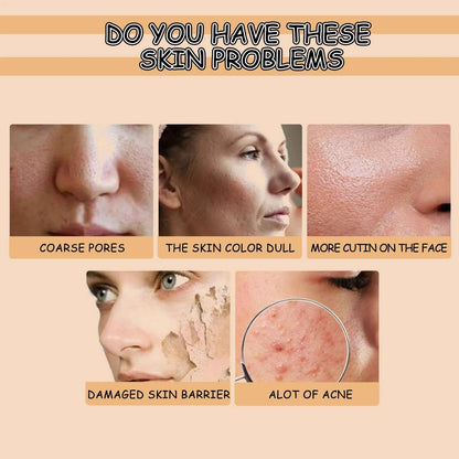 Ouhoe Niacinamide Serum Face Cleanser Brighten Skin Acne Removal Whitening Clean Pores Keratins Remove Moisturizing Skin Care