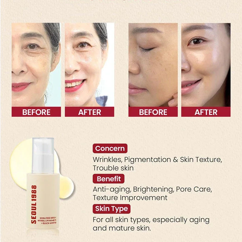 SEOUL 1988 Eye Cream Niacinamide 2% Retinal Acid Ginseng Serum Lighten Fine Lines Firming Pores Brightening Face Korean Skincare - AMULET RING STORE