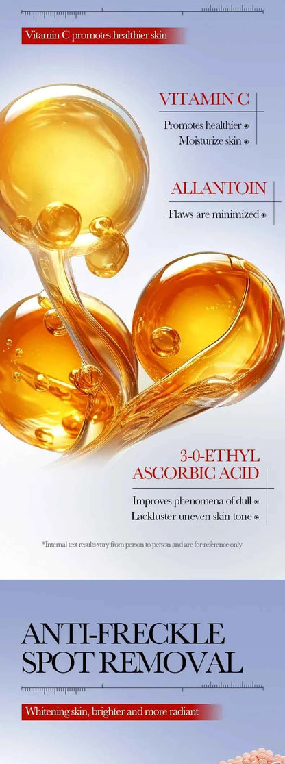 Effective Whitening Freckles Face Cream Dark Spot Corrector Remove Melasma Fade Melanin Pigmentation Brighten Skin Care Products