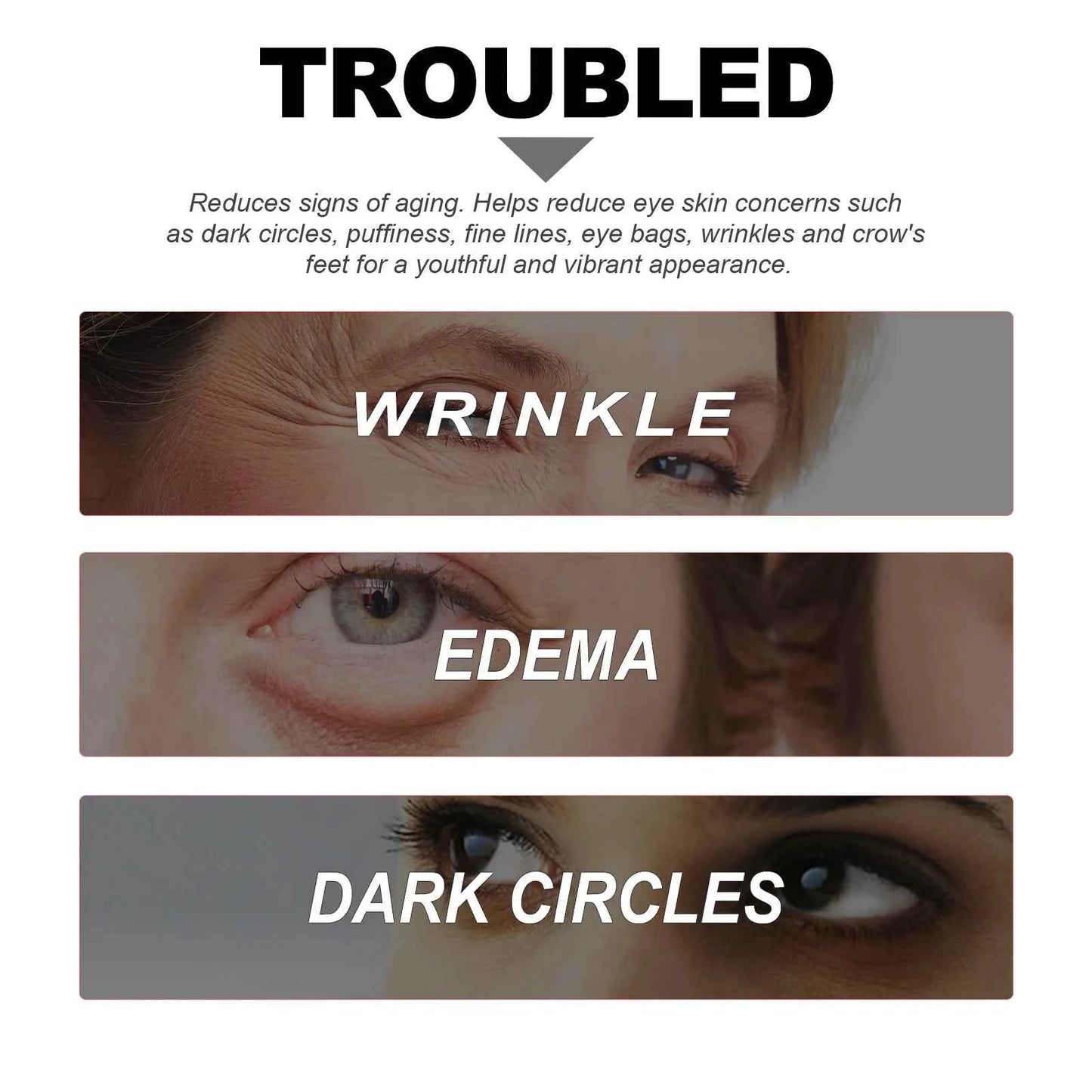 Niacinamide Eye Cream Reduces Dark Circles and Eye Bags Sodium Hyaluronate Moisturizing Essence Reduces Puffiness Eye Care