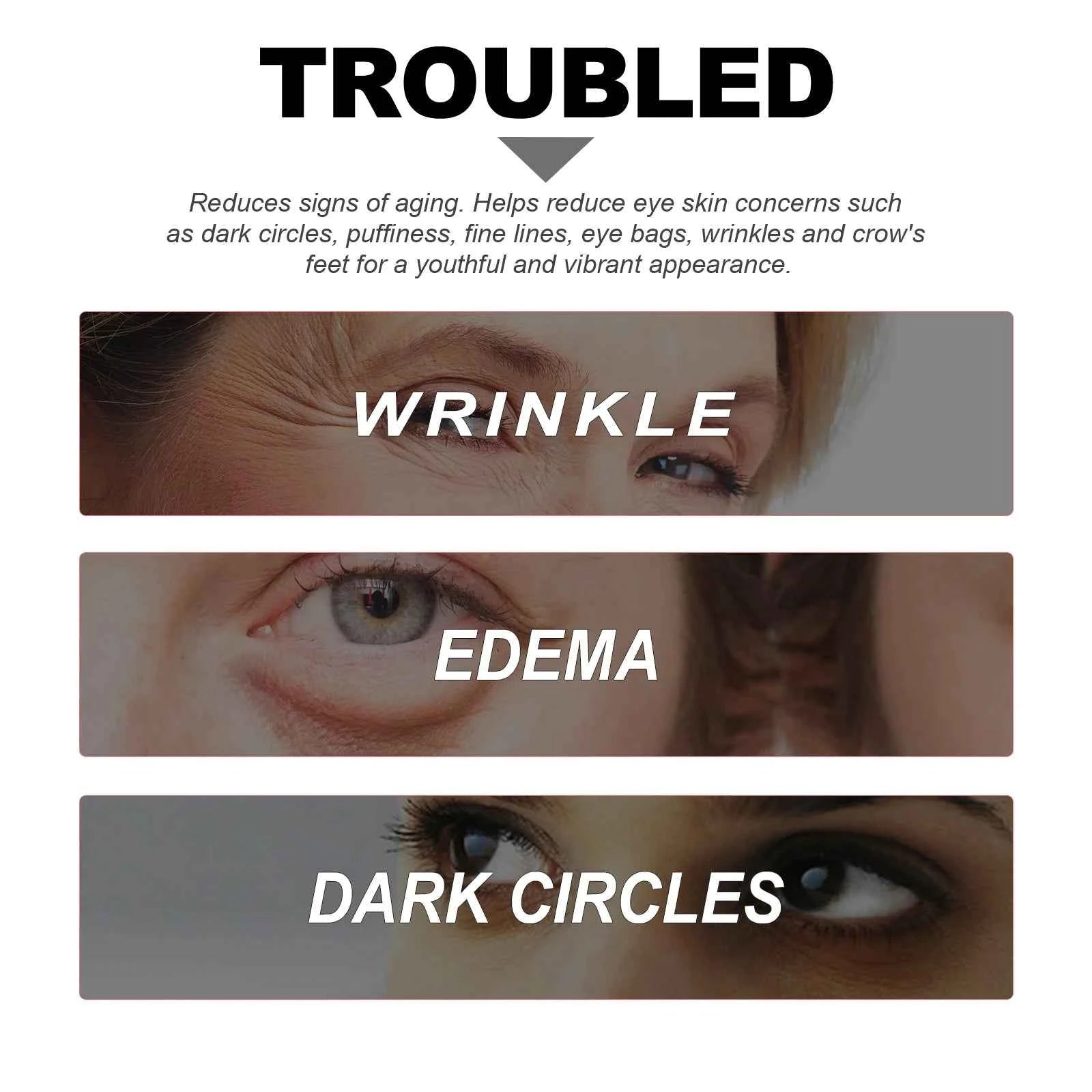 Niacinamide Eye Cream Reduces Dark Circles and Eye Bags Sodium Hyaluronate Moisturizing Essence Reduces Puffiness Eye Care