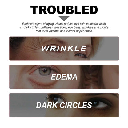 Niacinamide Eye Cream Reduces Dark Circles and Eye Bags Sodium Hyaluronate Moisturizing Essence Reduces Puffiness Eye Care