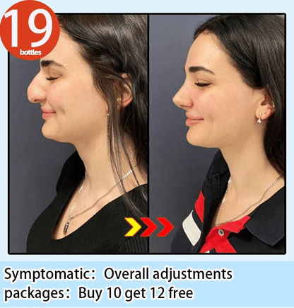 Nose Massage Essential Oil Up Heighten Rhinoplasty Firming For Moisturizing Nose Serum Reshape Natural Face Beauty Care Products - AMULET RING STORE