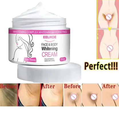 Brightening Cream For Intimate Parts Body Knees Remove Dull Pigments Brighten Serum Elbows Knuckles Lightening Skin Care Product - AMULET RING STORE