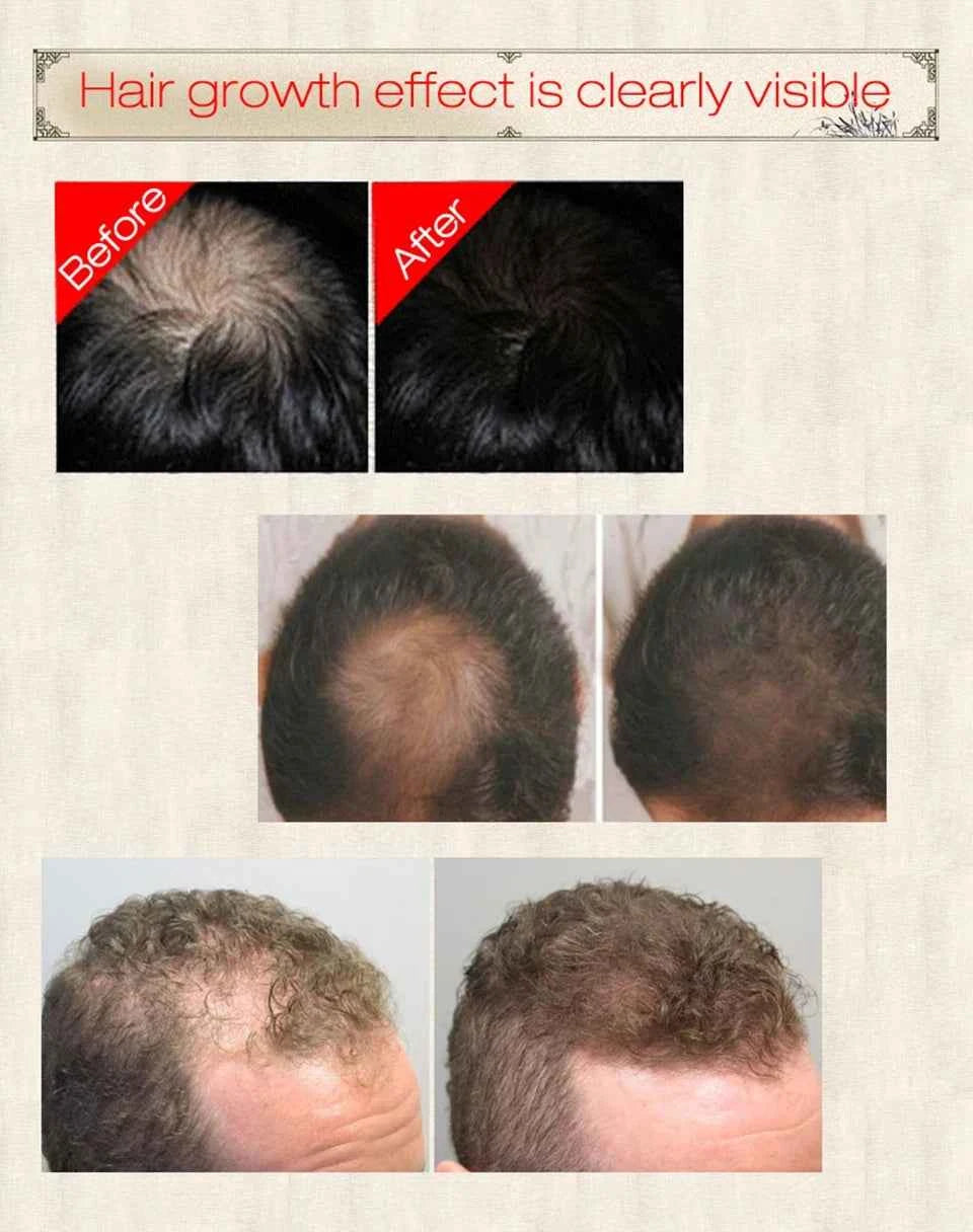 30ml Ginger Hair Growth Essence Hair Care Liquid Strengthen Hair Roots Increase Hair Luster Massag Scalp Repair Hair Essence Oil