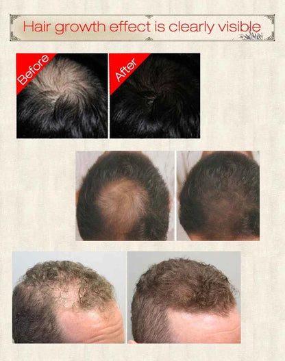 30ml Ginger Hair Growth Essence Hair Care Liquid Strengthen Hair Roots Increase Hair Luster Massag Scalp Repair Hair Essence Oil