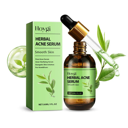 Acne Face Cream Pimple Treatment Oil Control Repair Redness Remove Blackhead Smooth Hydrating Moisturizing Pore Shrinking Serum - AMULET RING STORE