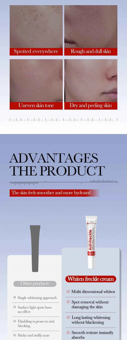 Effective Whitening Freckles Face Cream Dark Spot Corrector Remove Melasma Fade Melanin Pigmentation Brighten Skin Care Products