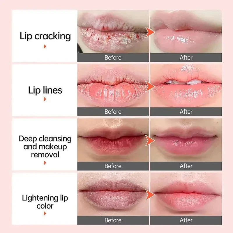 Remove Dark Lip Balm Bubble Lightening Pink Lip Exfoliating Fade Lip Line Dead Skin Moisturizer Beauty Health Lip Care Products - AMULET RING STORE