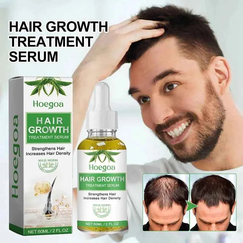 Fast Hair Growth Oil Rosemary Africa Crazy Traction Alopecia Serum Anti Hair Break Thicken Hair Loss Essential Oil For Man Women