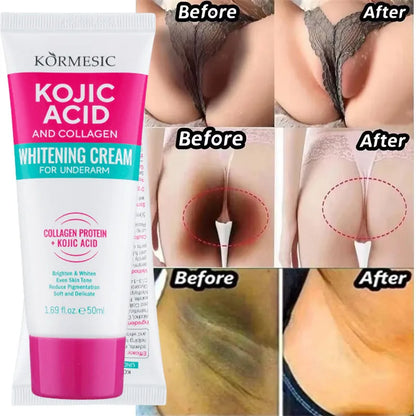 Whitening Cream Private Parts Underarm Bleaching Serum Whiten Butt Knee Brighten Inner Thigh Intimate Parts Dark Remove Melanin