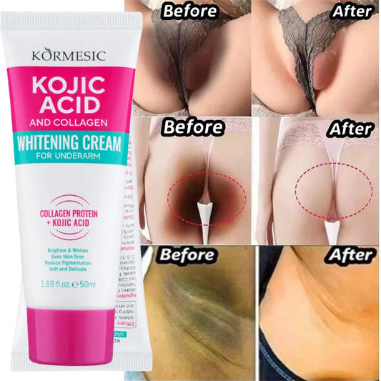 Whitening Cream Private Parts Underarm Bleaching Serum Whiten Butt Knee Brighten Inner Thigh Intimate Parts Dark Remove Melanin