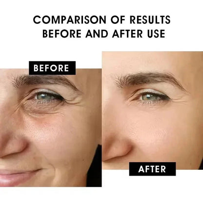 Hoygi Blue Copper Peptide Serum Anti Wrinkles Aging Rejuvenating Facial Lifting Moisturizing Brighten Skin Tone Skin Cosmetics - AMULET RING STORE