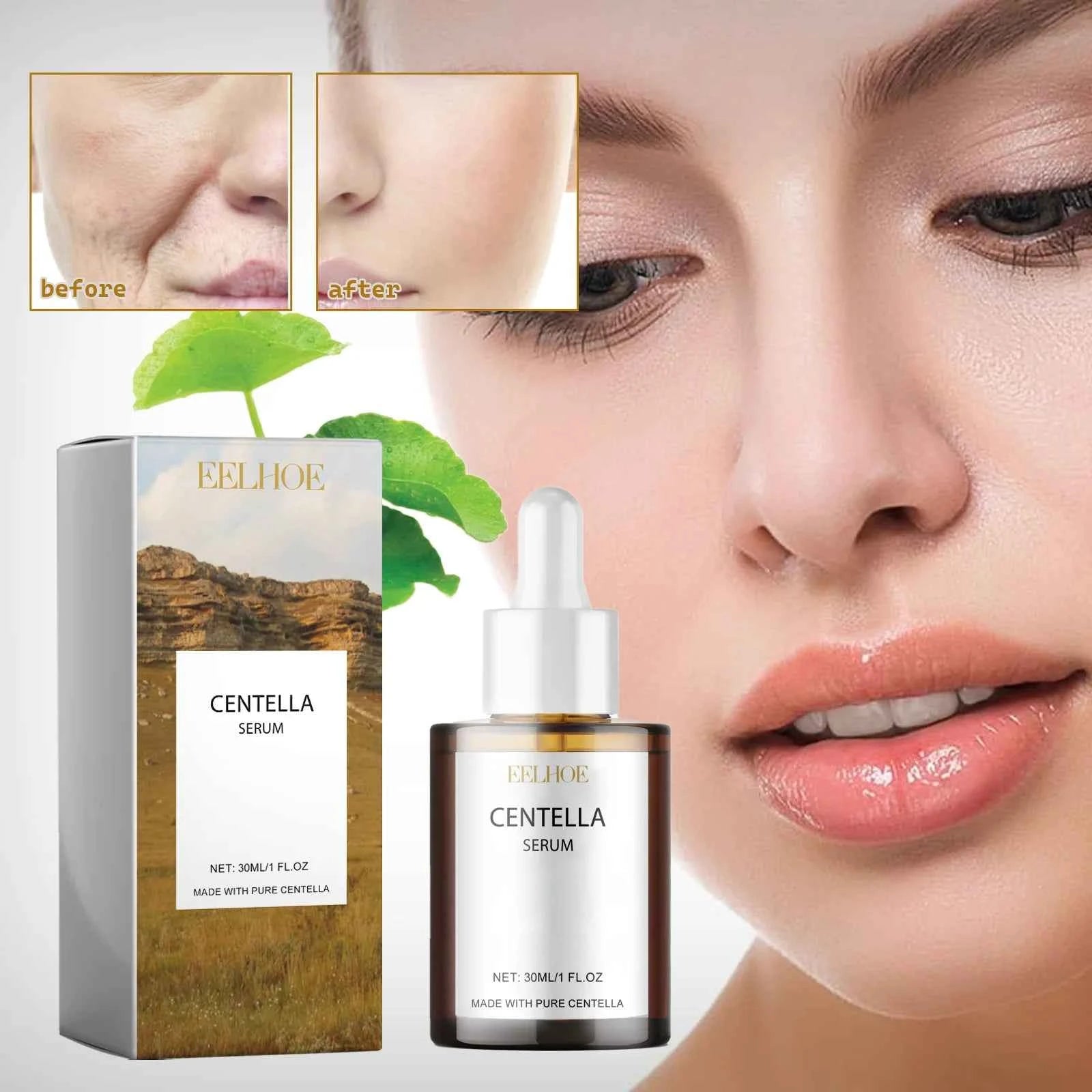 EELHOE Centella asiais essence moisturizing improve dry skin smooth tender skin brightening moisturizing essence