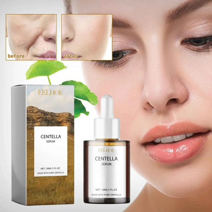 EELHOE Centella asiais essence moisturizing improve dry skin smooth tender skin brightening moisturizing essence