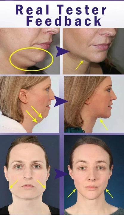 Effective V-Shape Face Slimming Lifting Facial Cream Lift Up V Double Chin Cheek Slimming Firming Anti Wrinkle Beauty Skin Care - AMULET RING STORE