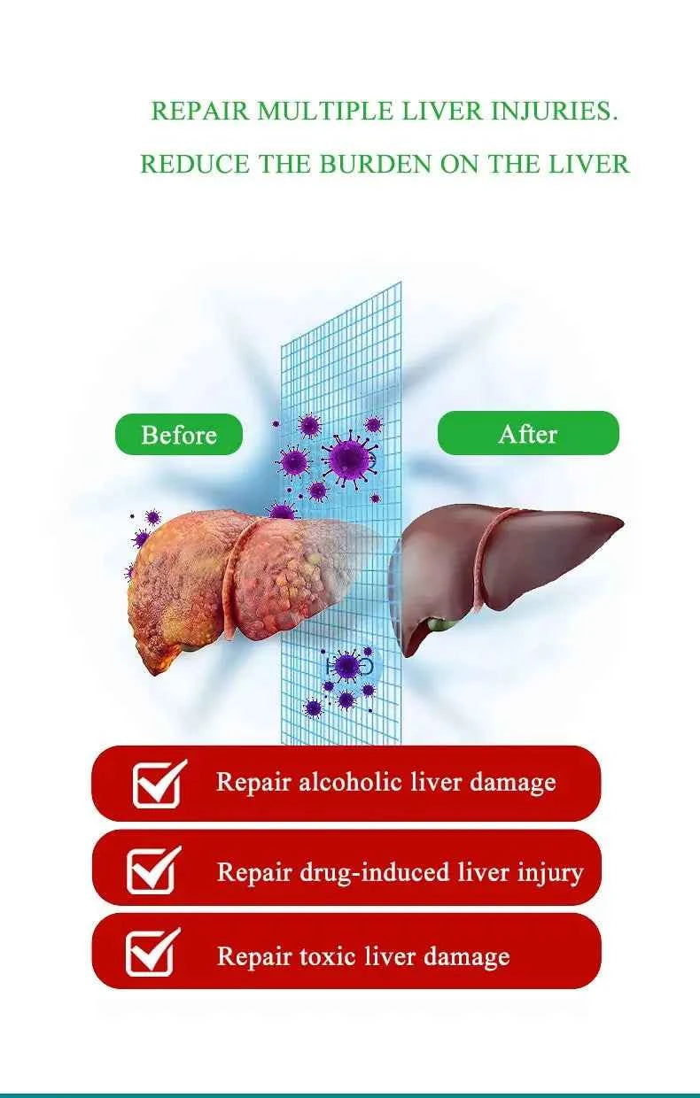 Liver Cleansing Detox Capsules Health Liver Support Colon Cleansing Repair Pills Prevent Cirrhosis Fatty Liver, Natural Herbal