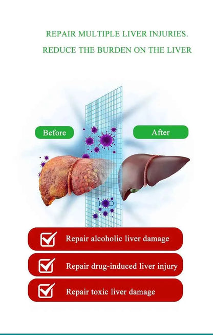 Liver Cleansing Detox Capsules Health Liver Support Colon Cleansing Repair Pills Prevent Cirrhosis Fatty Liver, Natural Herbal