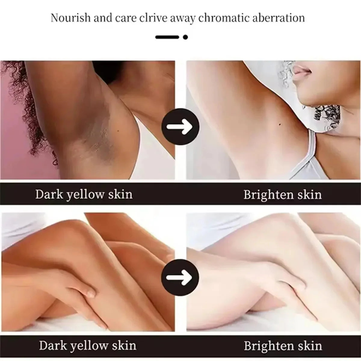 Whitening Cream Private Parts Underarm Bleaching Serum Whiten Butt Knee Brighten Inner Thigh Intimate Parts Dark Remove Melanin