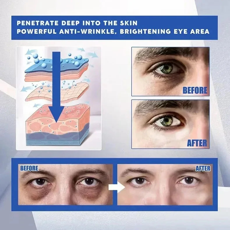 Instant Eye Bag Remove Eye Cream Anti Fat Particles Dark Circles Puffiness Fade Fine Lines Lift Brighten Korean Beauty Eye Care - AMULET RING STORE