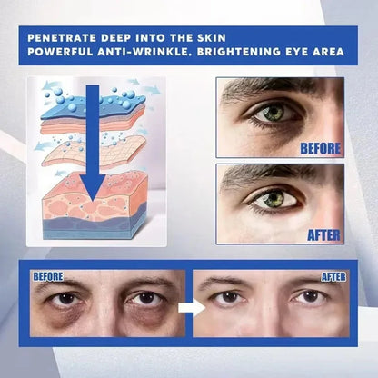 Instant Eye Bag Remove Eye Cream Anti Fat Particles Dark Circles Puffiness Fade Fine Lines Lift Brighten Korean Beauty Eye Care - AMULET RING STORE