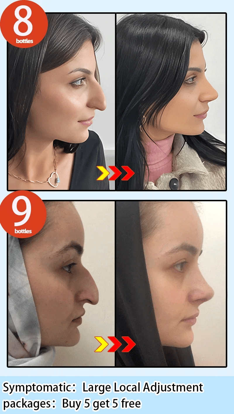 Nose Massage Essential Oil Up Heighten Rhinoplasty Firming For Moisturizing Nose Serum Reshape Natural Face Beauty Care Products - AMULET RING STORE