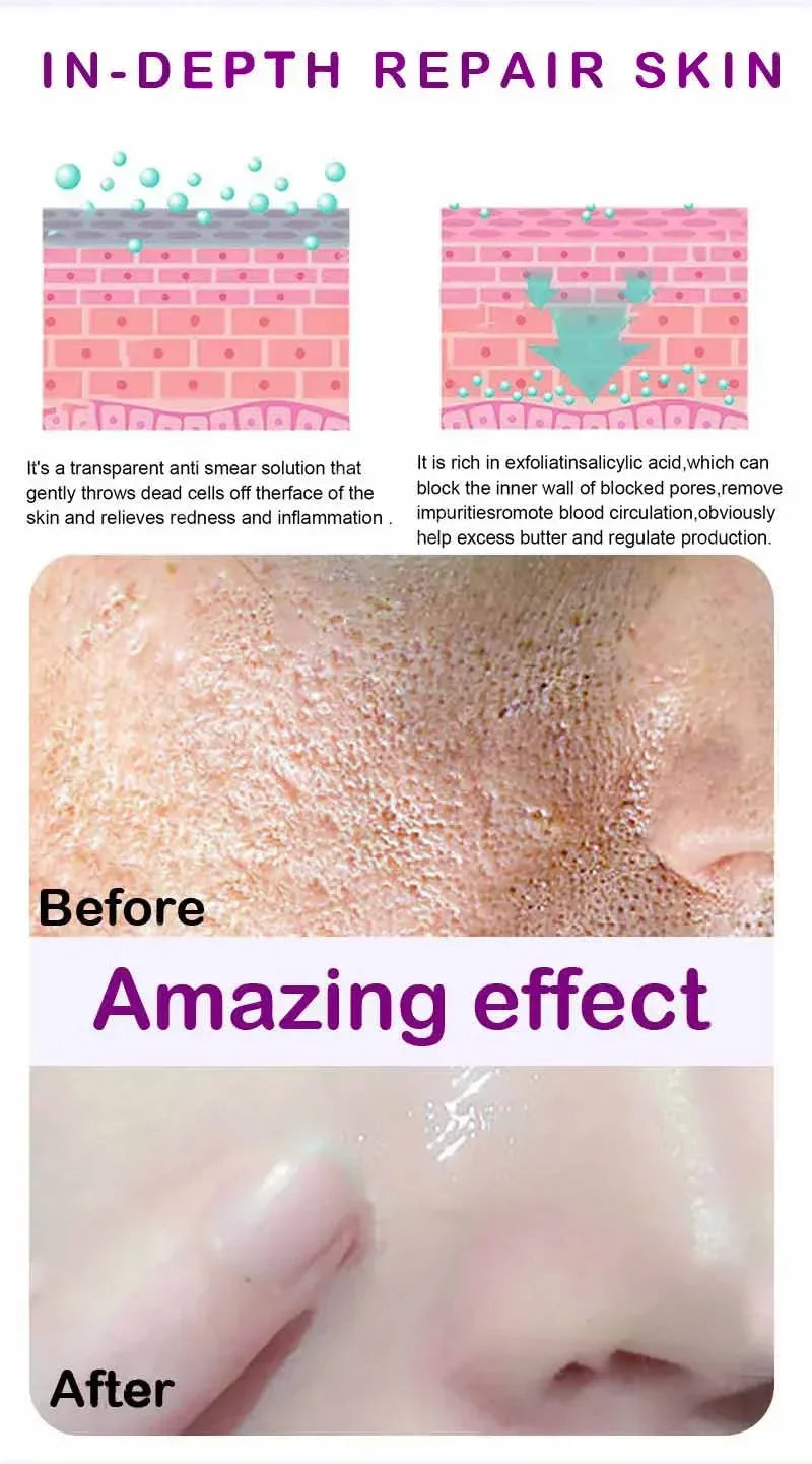 Skin Texture | Pore Refining Resurfacing, Brightening Facial Serum with Retinol and Niacinamide Non-Comedogenic - AMULET RING STORE