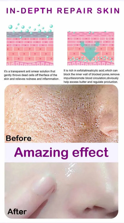 Skin Texture | Pore Refining Resurfacing, Brightening Facial Serum with Retinol and Niacinamide Non-Comedogenic - AMULET RING STORE