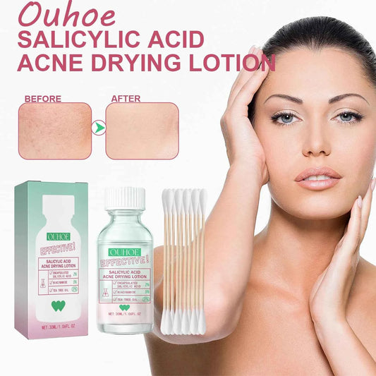 Ouhoe Salicylic Acid Acne Care Lotion Gentle Acne Treatment Pore Shrink Nourishing Improve Skin Texture Glowing Acne Care Lotion