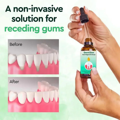 30ml Quickly Repair Of Cavities Caries Drops Serum Teeth Remove Yellow Plaque Stains Relieve Gums Decay Serum - AMULET RING STORE