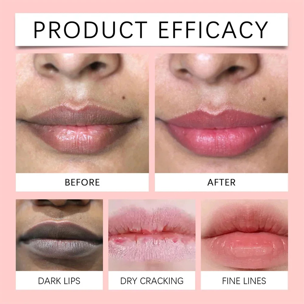 Remove Dark Lip Balm Fast Lightening Pink Lip Exfoliating Fade Lip Line Dead Skin Moisturizer Korean Care Products Beauty Health - AMULET RING STORE