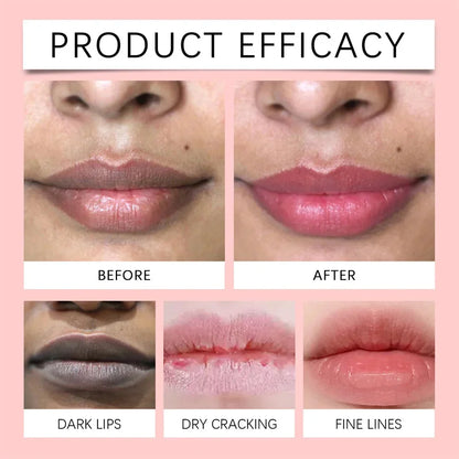 Remove Dark Lip Balm Fast Lightening Pink Lip Exfoliating Fade Lip Line Dead Skin Moisturizer Korean Care Products Beauty Health - AMULET RING STORE