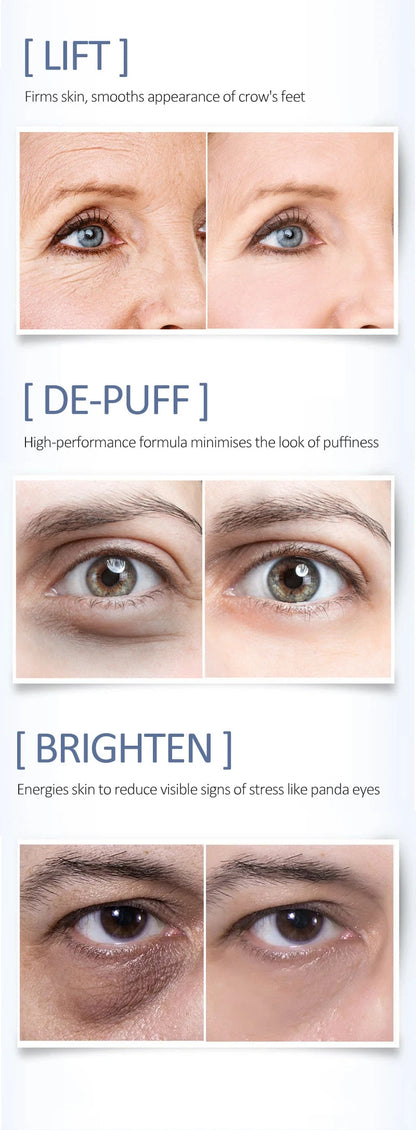 OCHEAL Eye Moisturizing Cream Fades Fine Lines Anti Dark Circles Eye Serum Remove Eye Bag Puffiness Anti-Aging Firmness Eye Care - AMULET RING STORE