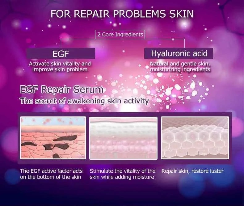 ARTISCARE Serum for Face 8pcs/Lot for Moisturizing Hyaluron Acid Vitamain C Six Peptide Q10 VC Facial Essence Skin Care