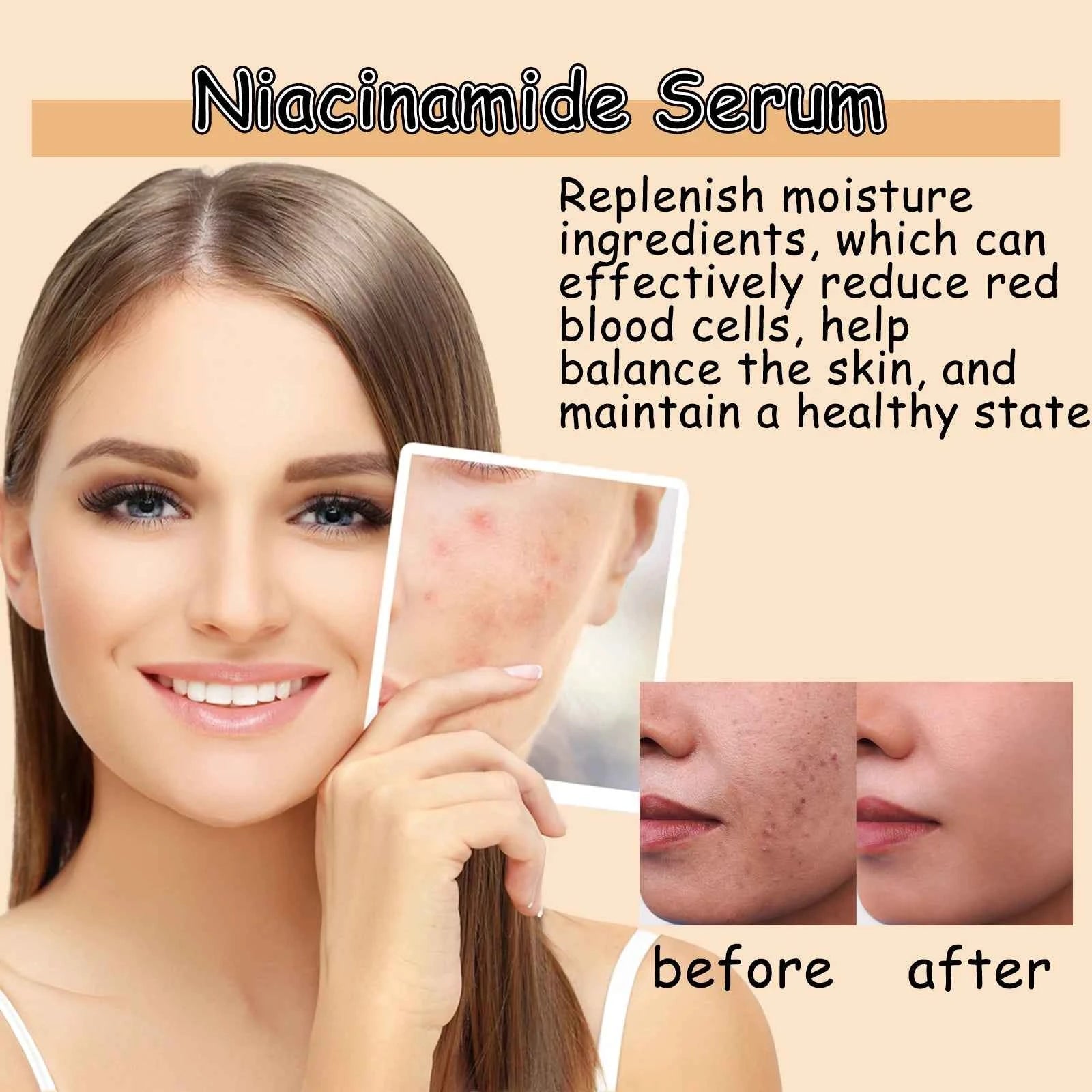 Ouhoe Niacinamide Serum Face Cleanser Brighten Skin Acne Removal Whitening Clean Pores Keratins Remove Moisturizing Skin Care