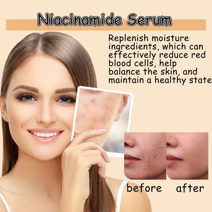Ouhoe Niacinamide Serum Face Cleanser Brighten Skin Acne Removal Whitening Clean Pores Keratins Remove Moisturizing Skin Care