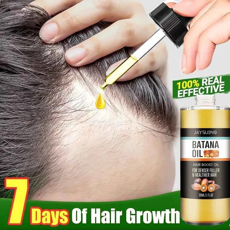 Fast Hair Growth Set Batana Oil Traction Alopecia Hair Mask Anti Break Loss Hair Growth Oil Baldness Treatment Hair Health Care